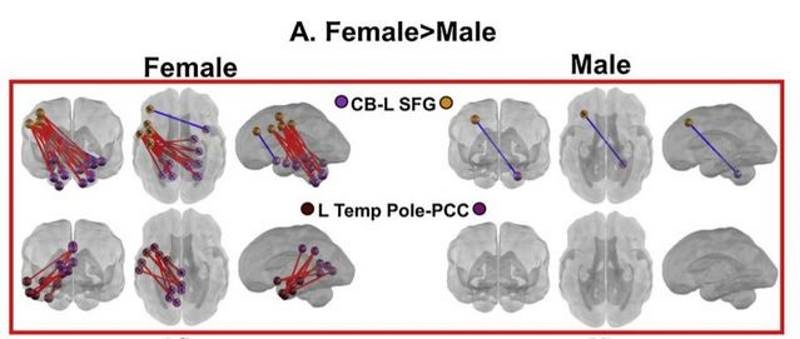 Click to enlarge brain sex differences prior to birth