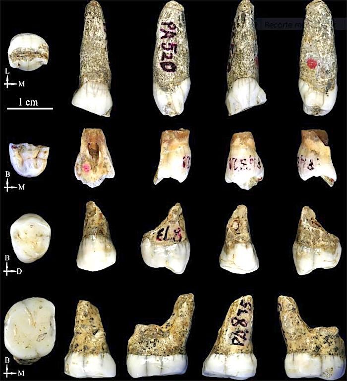 teeth