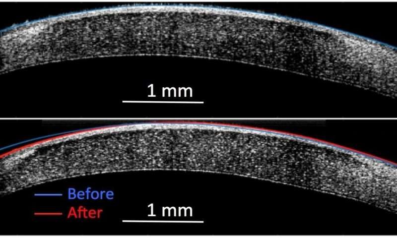 Click to enlarge electricity tissue
