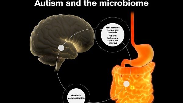 Click to enlarge Gut brain communication.