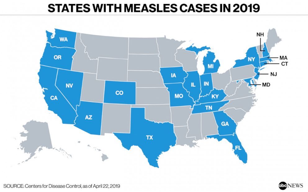 US measles cases by state 2019