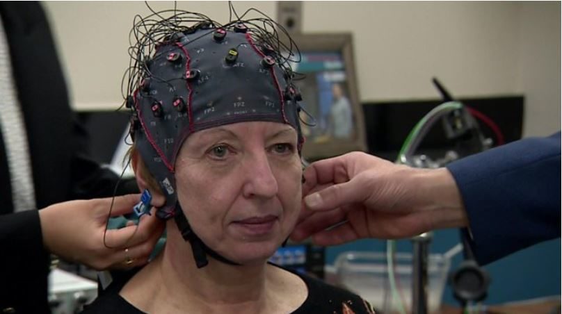 Parkinson's treament spine implant