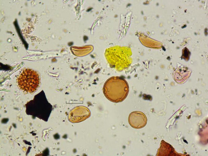 Click to enlarge pollen