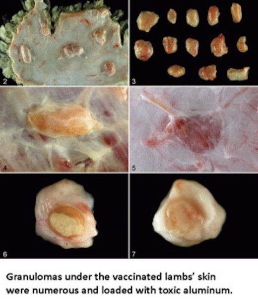 Click to enlarge granulomas