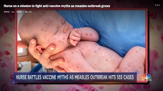 doctored image measles fake