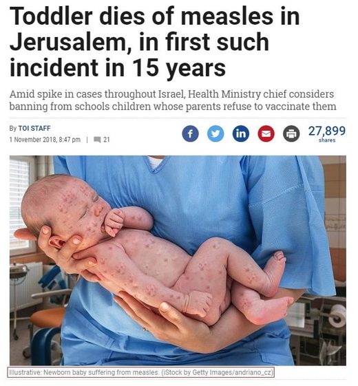 times of israel toddler measles