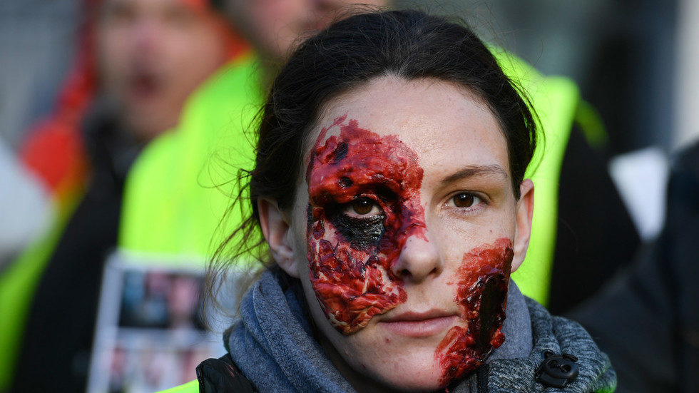 yellow vest injury protest