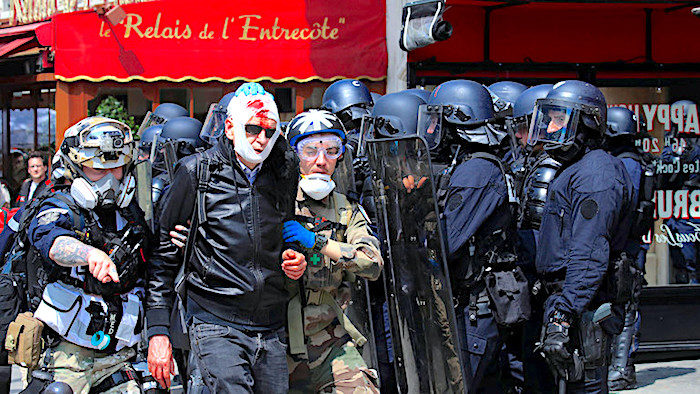 Click to enlarge Injury Paris