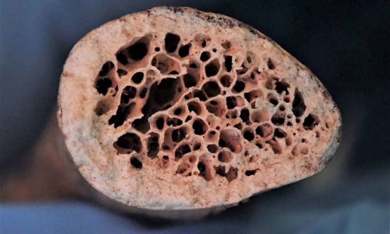 Click to enlarge normal bone