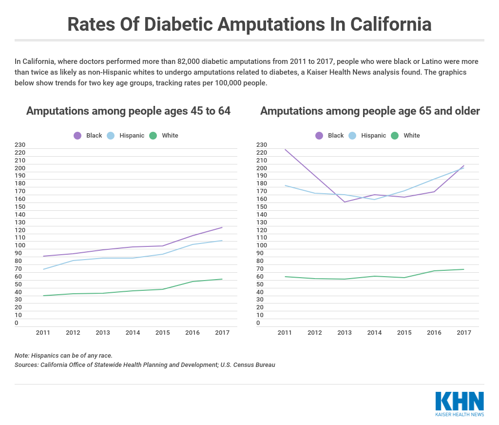 california amputations diabetes