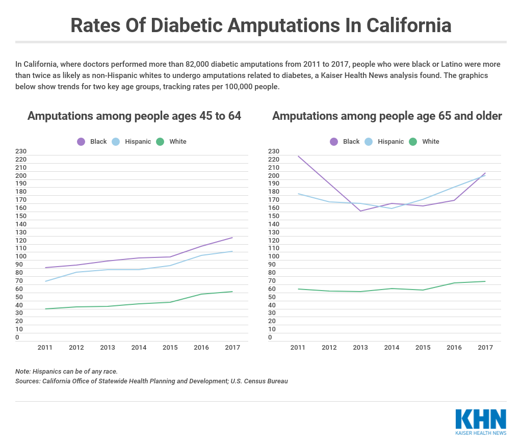 Click to enlarge california amputations diabetes