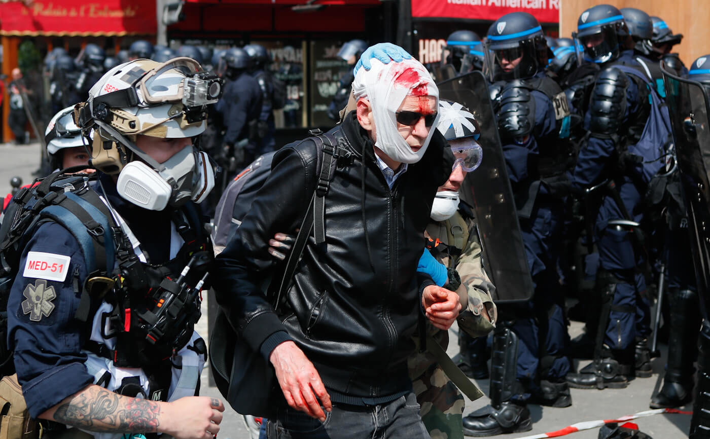 Click to enlarge protest injury