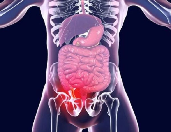 appendix attack