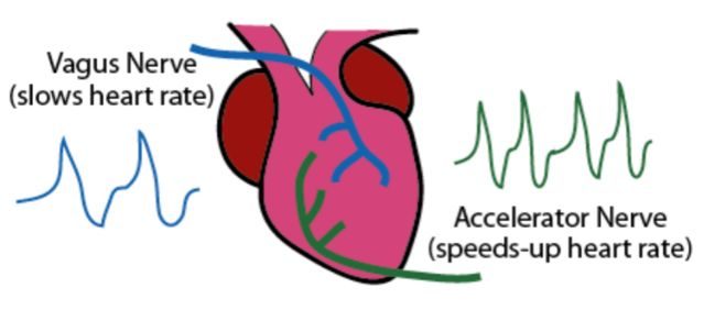 Click to enlarge Vagus nerve stimulation diagram