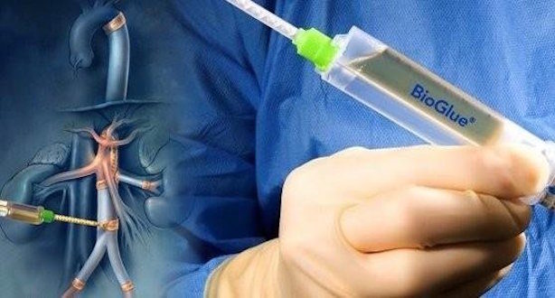 Bioglue, wound healing