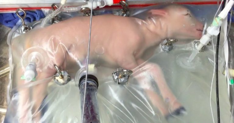 Study: Artificial womb technology and the frontiers of human reproduction: conceptual differences and potential implications