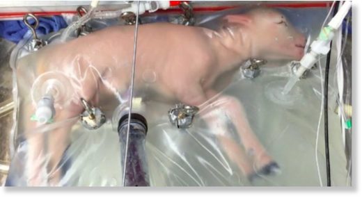 Study: Artificial womb technology and the frontiers of human reproduction: conceptual differences and potential implications
