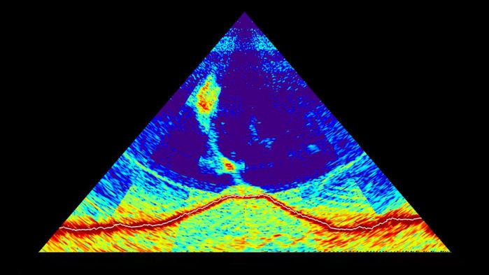 Click to enlarge Mayotte gas plume underwater