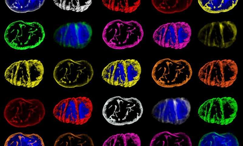 Click to enlarge cell web