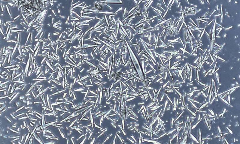 Click to enlarge Charcot-Leyden Crystals