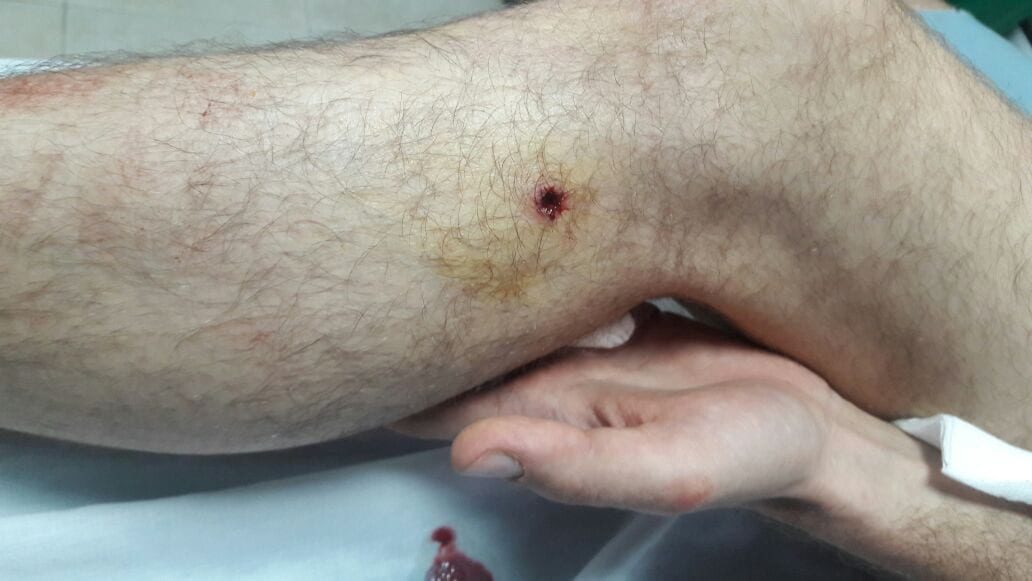 Click to enlarge Tarek Loubani wounded medic Gaza