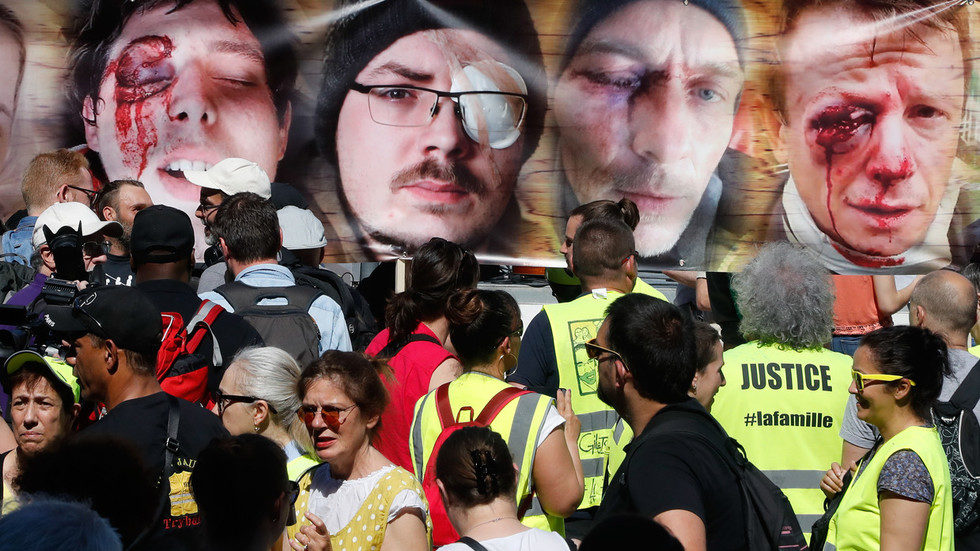 yellow vest injured