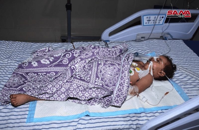Click to enlarge Child injured in West Aleppo by missiles fired from Nusra Front