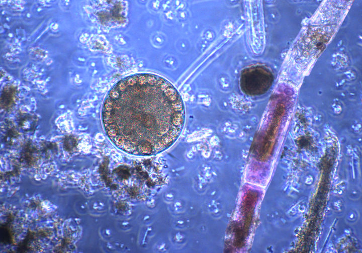 microscopic life