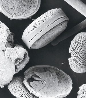 diatoms