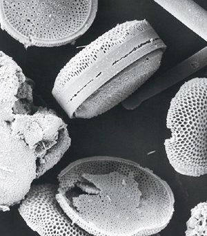 Click to enlarge diatoms