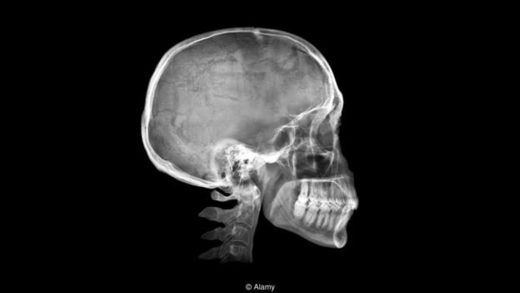 Click to enlarge overbite