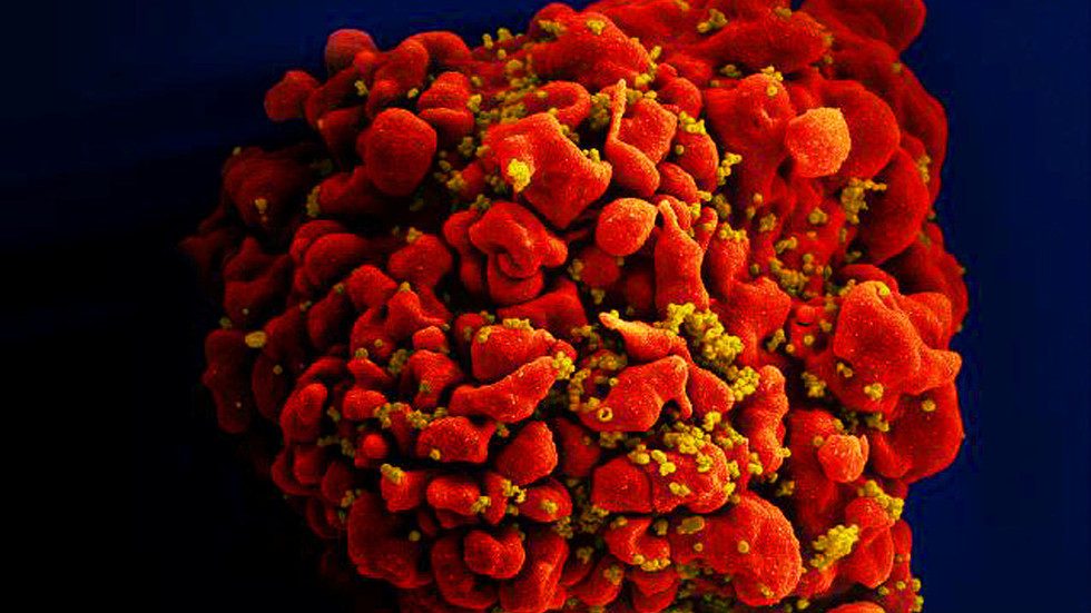 HIV virus