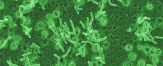 Mycobacterium vaccae