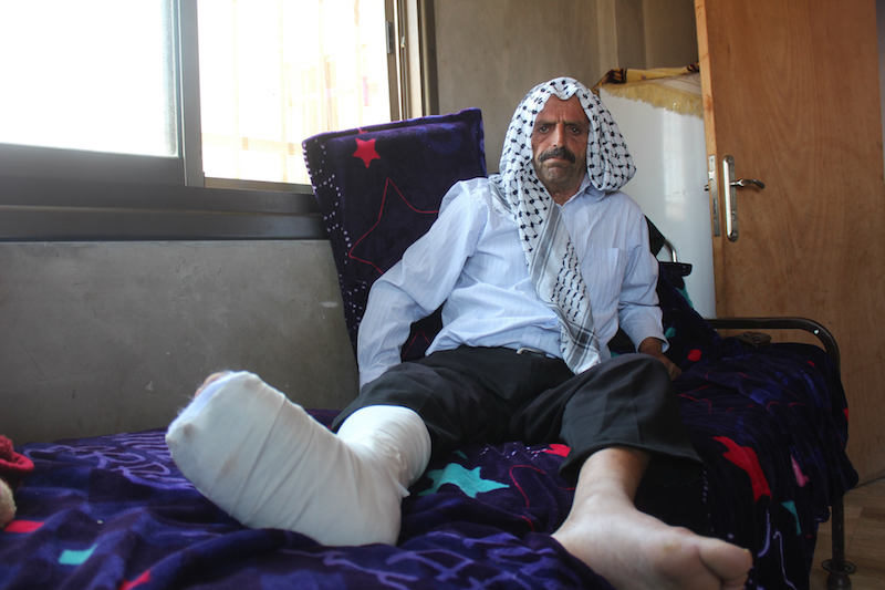 Kamal Abdullah al-Naasan rests his broken foot following a settler attack (MEE/Shatha Hammad) Kamal Abdullah al-Naasan rests his broken foot following a settler attack