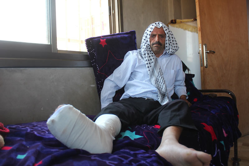 Click to enlarge Kamal Abdullah al-Naasan rests his broken foot following a settler attack (MEE/Shatha Hammad) Kamal Abdullah al-Naasan rests his broken foot following a settler attack