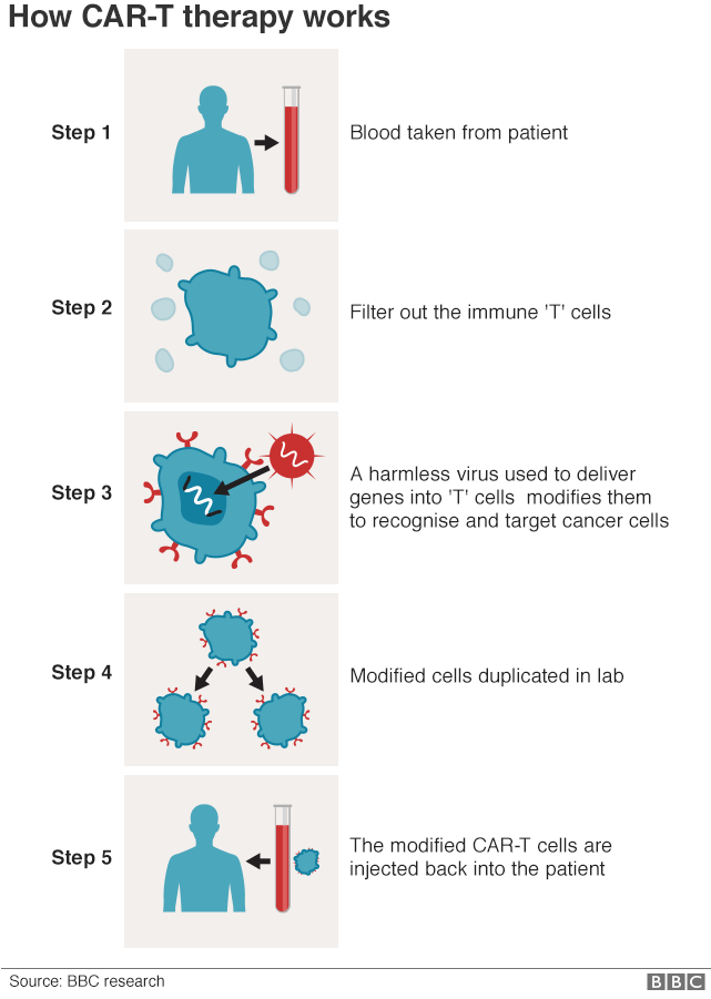 CAR-T therapy