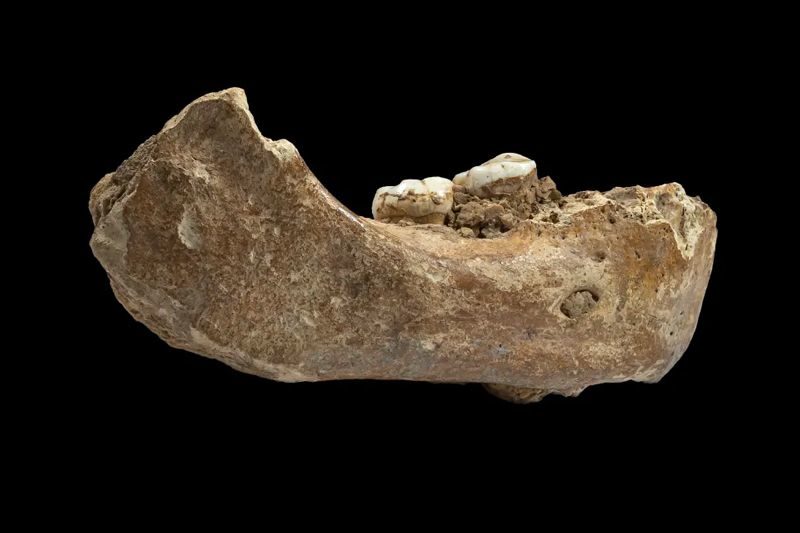 jawbone