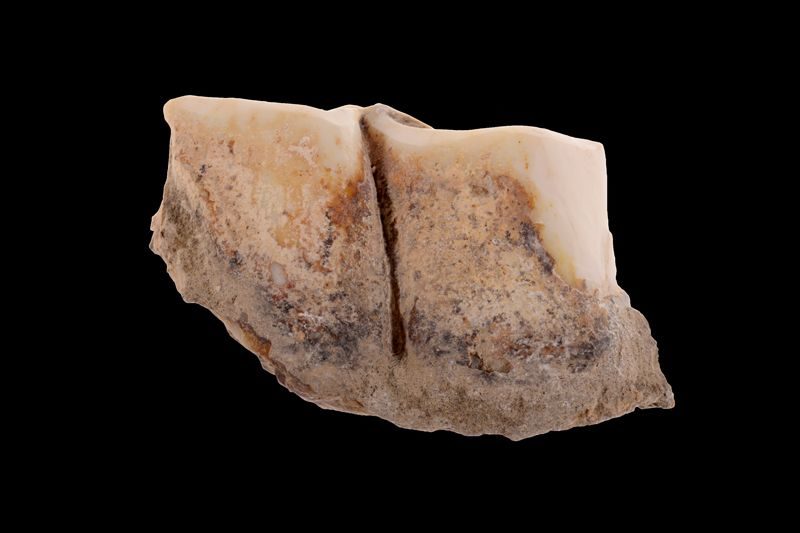 tooth