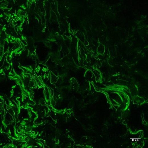 Click to enlarge eye microbiome
