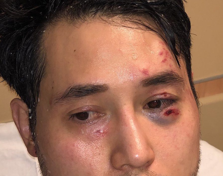 Click to enlarge andy ngo