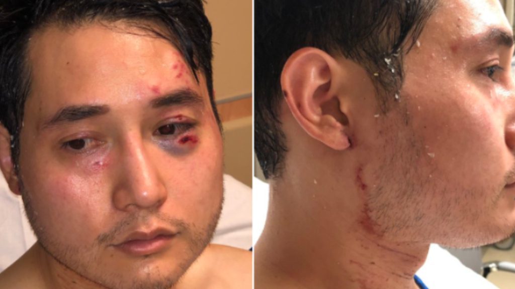Click to enlarge Andy Ngo