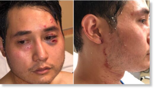 Click to enlarge Andy Ngo