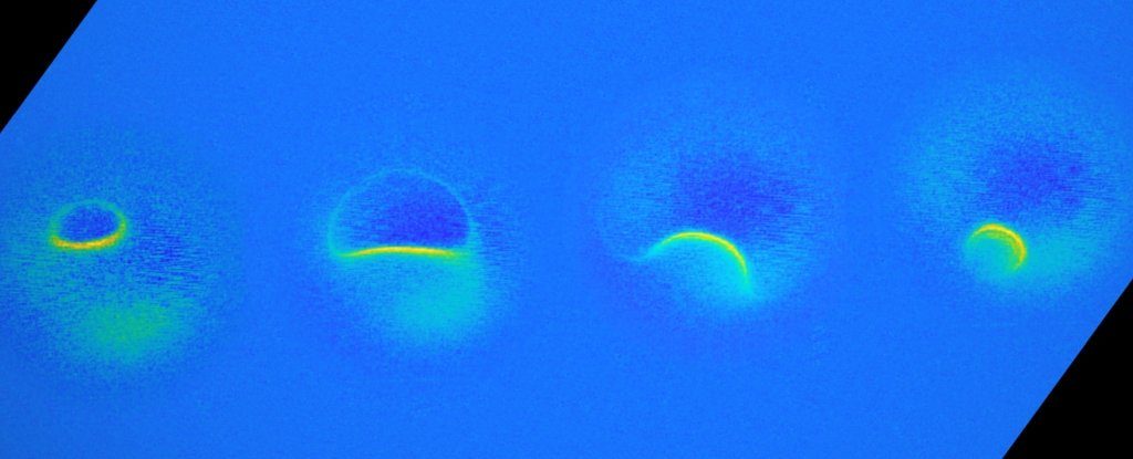 single atom MRI