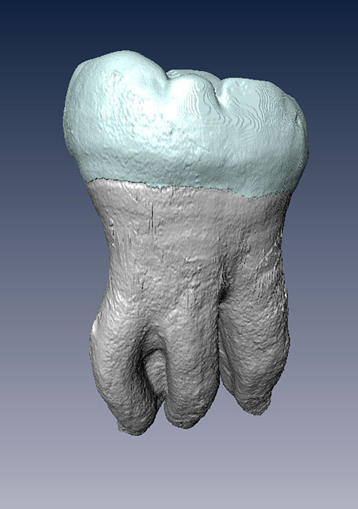 Click to enlarge Molar Denisovan