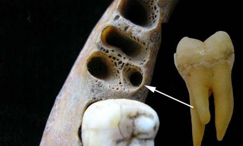 Molar comparison
