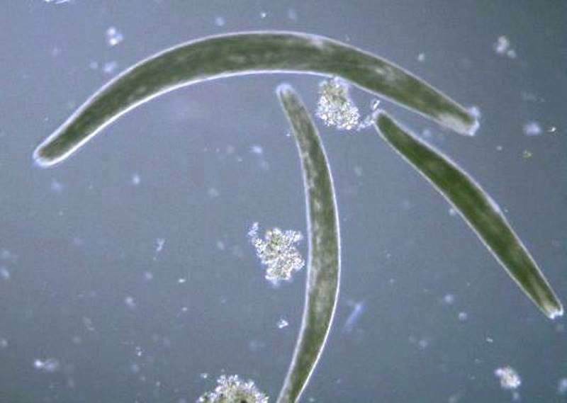Spirostomum ambiguum