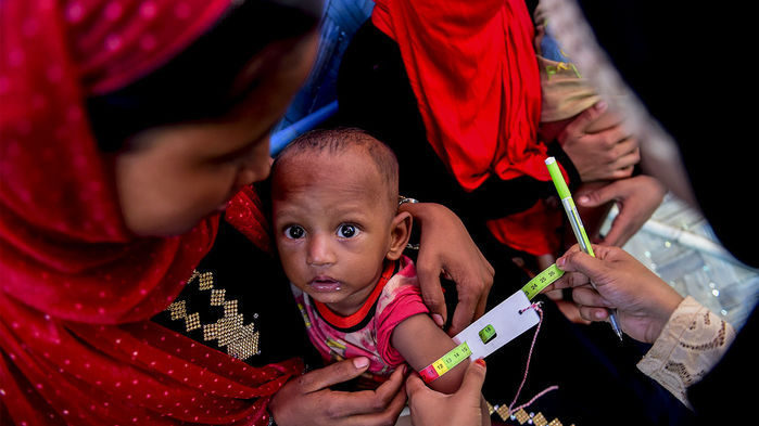 child Bangladesh malnutrition
