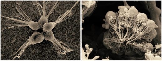 Click to enlarge choanoflagellates