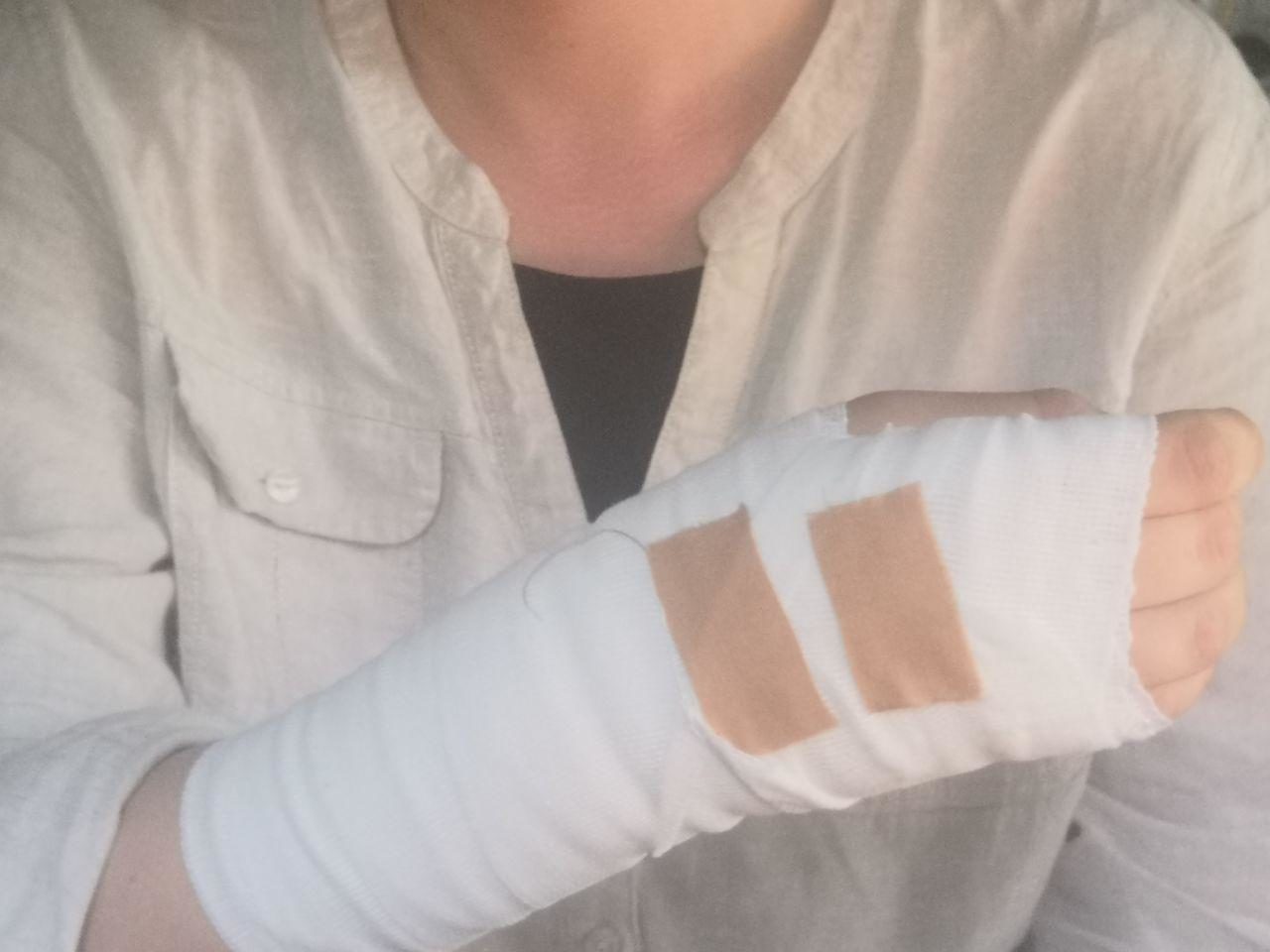 Click to enlarge Beatrice-Lily Richardson’s arm injuries beating israeli soldiers