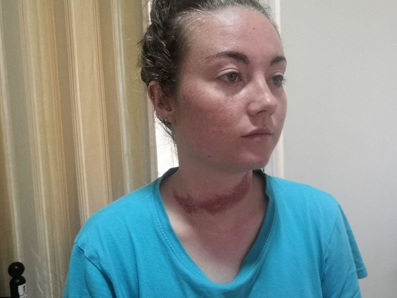 Click to enlarge Bethany Rielly beating israeli soldiers